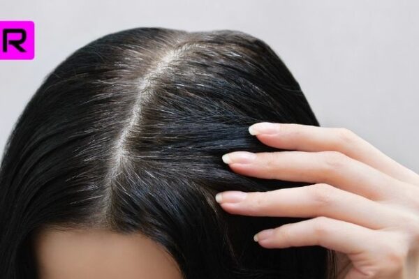 Best 14 Tips How To Reduce White Hair